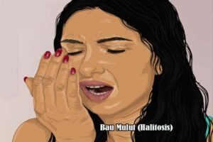 Penanganan Praktis Penderita Bau Mulut (Halitosis)