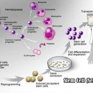 Terapi Sel Punca