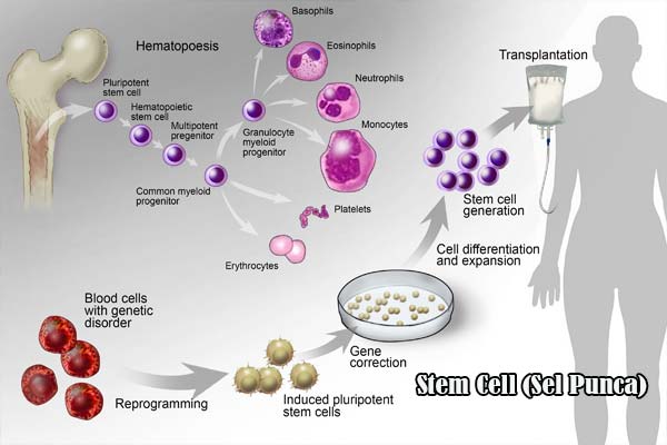 Terapi Sel Punca